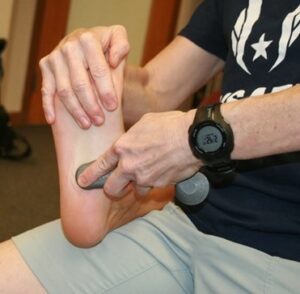 Fascial Abrasion for plantar fasciitis